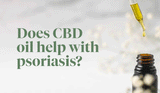 Does CBD oil help with Psoriasis?