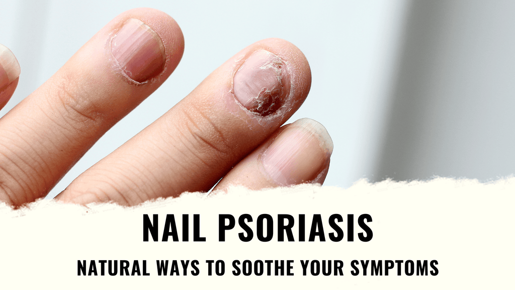 psoriasis on fingernails